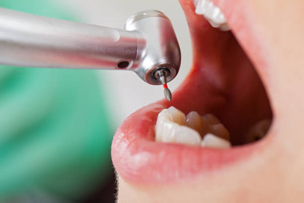 Best Urgent Care for Lost Fillings or Crowns in Feasterville, PA
